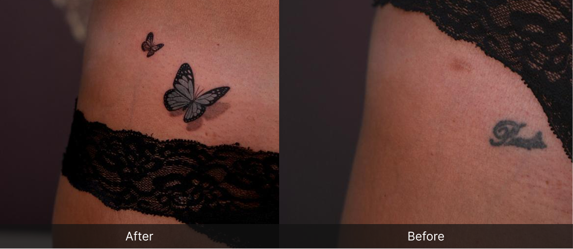 Cover-Up vs. Removal: Which Should You Choose? 🤔